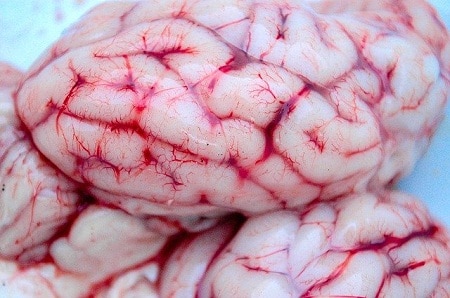新鲜的大脑